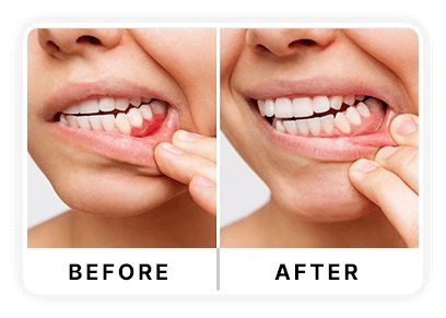 Healthy Rebuilt Smile Transformation